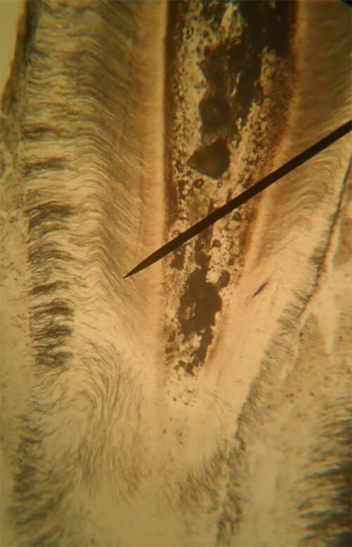 Figura 4: Porción radicular de la pieza dentaria bovina. 40 X se observa disposición irregular de los túbulos dentinarios.