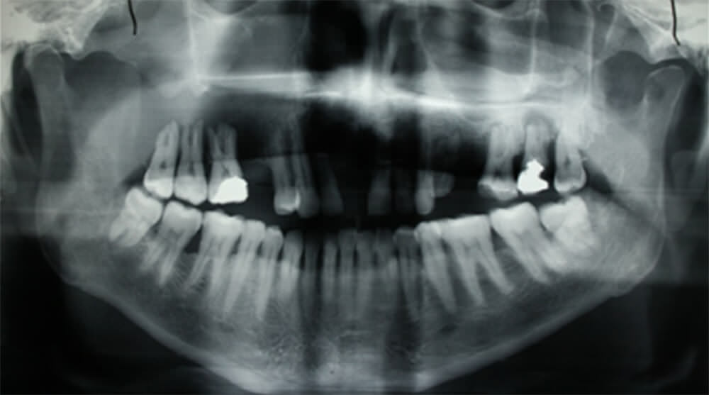 Figura. 2: Radiografía panorámica