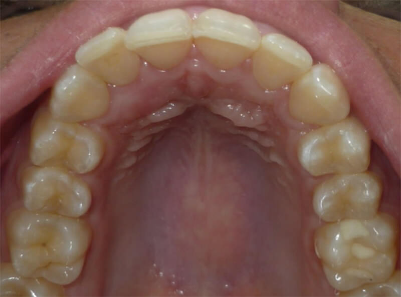 Figura 6. Corte histológico con Hematoxilina-Eosina 40X