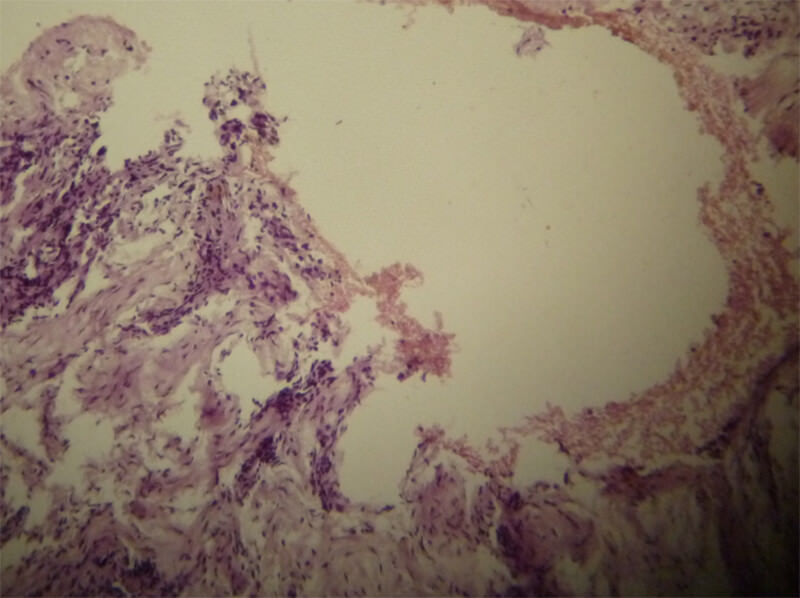 Figura 7. Corte histológico de Hematoxilina-Eosina 40X