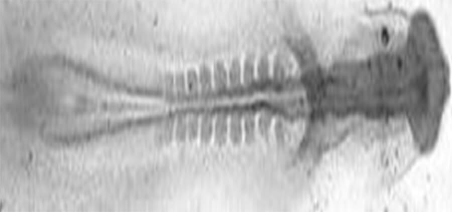 Figura 1. Tubo neural parcialmente abierto (extremo izquierdo), somitas rodeándolo en el centro, y dilataciones cerebrales a la derecha.