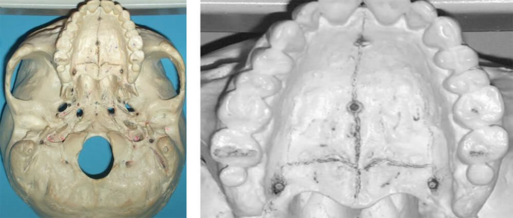 Figura 6. M.C. Paladar definitivo óseo. Material cadavérico de base craneal humana.