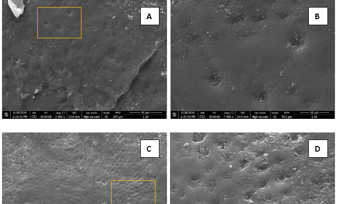 Figura 1. Microfotografías de la superficie vestibular del esmalte dental erosionado.