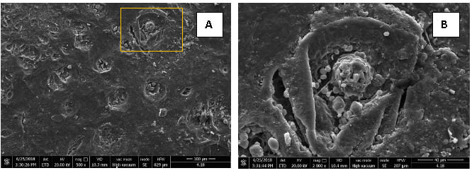 Figura 2. Microfotografías de la superficie vestibular del esmalte dental erosionado tratado con Bicarbonato de Arginina al 8% - carbonato de calcio.