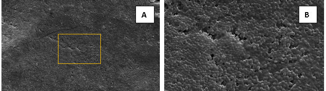 Figura 3. Microfotografías de la superficie vestibular del esmalte dental erosionado tratado con monofluorofosfato de sodio 0.76% y fluoruro de sodio 0.1%, con un contenido de flúor de 1450 ppm.