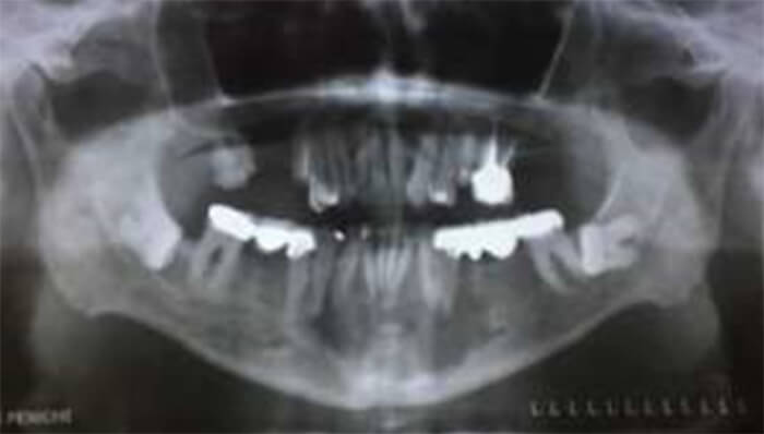 Figura 2. Radiografía panorámica.