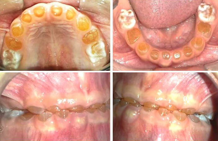 Figura 2. Examen intraoral