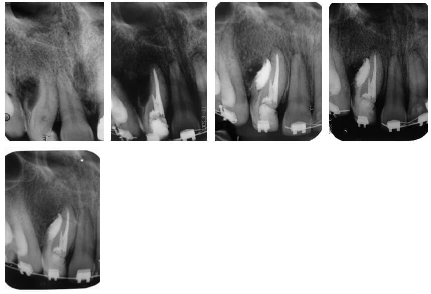 Fig. 1. Radiografías utilizadas en el caso.