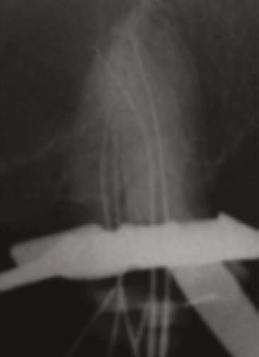 Figura 3. Rx Conductometría