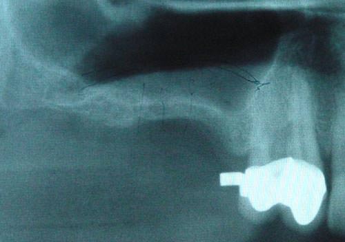 Fig.2