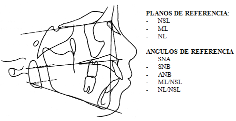 Fig. 5: Planos y ángulos de referencia utilizados para la determinación del grupo rotacional mandibular