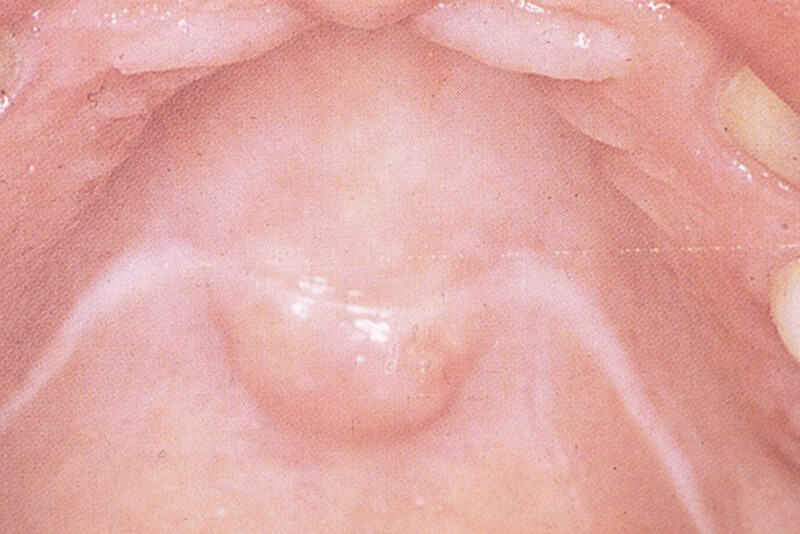 Foto nº 5