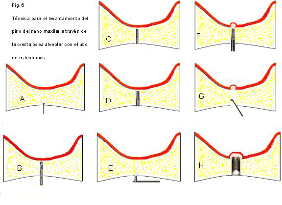 Fig. 6