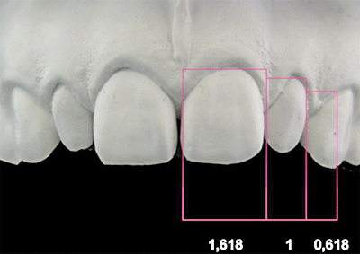 Figura 4. Proporción áurea.