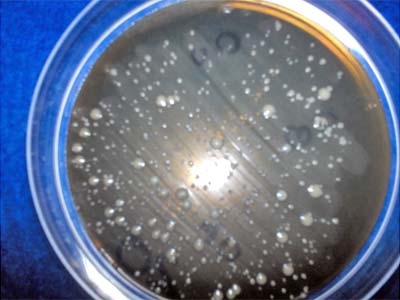 FIGURA 1: Colonias de E. faecalis en el medio Agar Enterococcus.