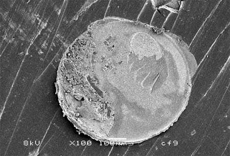 Figura 7 - Aspecto morfológico después del ensayo de microcizallamiento utilizando el Adper Single Bond. Se observa lafalla mixta (Aumento de 100 x)