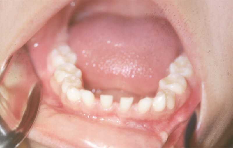 Figura 3 Aspecto intrabucal