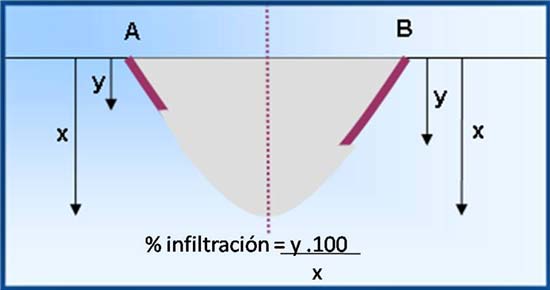 Figura 3: Medidas de penetración del tinte (y) y de la extensión de la cavidad (x) en las dos mitades de la restauración (A y B). Atención para el cálculo del porcentaje medio de infiltración en relación a la extensión de la cavidad para cada punto y posteriormente para cada sección.
