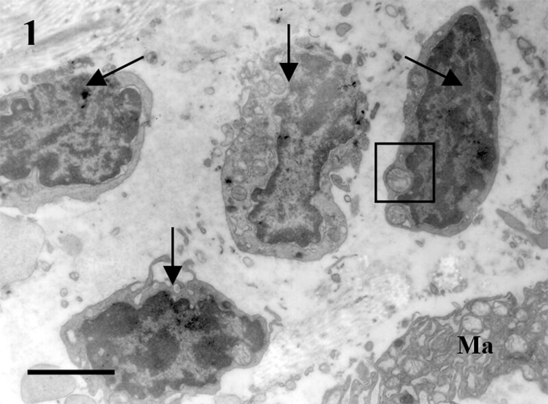 Fig.1 DEL: diferentes aspectos de los linfocitos (flechas). Ma: macrófago. Cuadrado: mitocondrias. Bar=1μm