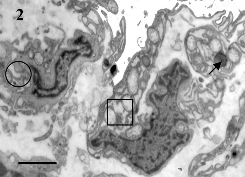 Fig 2.DEM: macrófagos. Cuadrado: mitocondrias. Círculo: vacuolas. Flecha: lisosoma. Bar=1μm