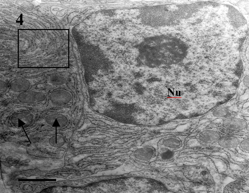 Fig 4. CA. Plasmocitos: Nu: núcleo, nótese la cercanía entre ellos y la abundancia de RER (cuadrado) y mitocondrias (flechas). Bar=0.5μm