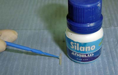 FIGURA 8 - Preparo del perno con silano