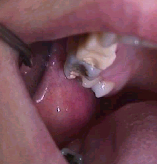 Figura 1
