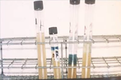 Figura 1: Crecimiento de T. tenax en medio de cultivo selectivo de Kupferberg (K.T.B.).