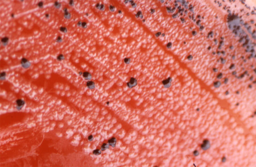 Figura 1. Crecimiento bacteriano en Agar Schaedler que muestra las colonias características de AGNP.