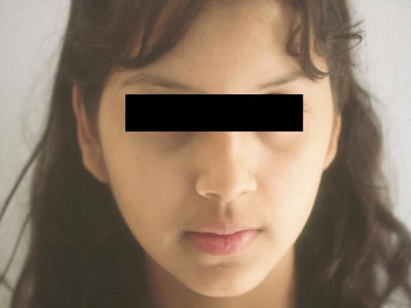 Figura 1: Aspecto extrabucal