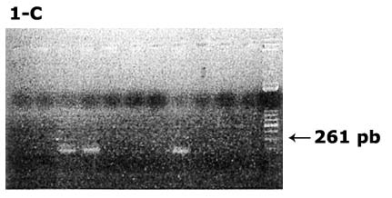 Carril 1: Marcador de Peso Molecular lambda leader 100 pb Carril 11: Muestra de saliva positiva para VHC Carril 15: Control positivo