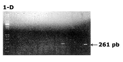 Carril 1: Marcador de Peso Molecular lambda leader 100 pb Carril 5, 9, 10: Muestra de saliva positiva para VHC