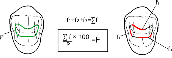 Fig. 1 Cuantificación de la desadaptación marginal. P= perímetro total de la restauración. fn= falla marginal (mm). Σf= Sumatoria en mm de fallas marginales (fn). F= Porcentaje del perímetro total que presentó desadaptación marginal.