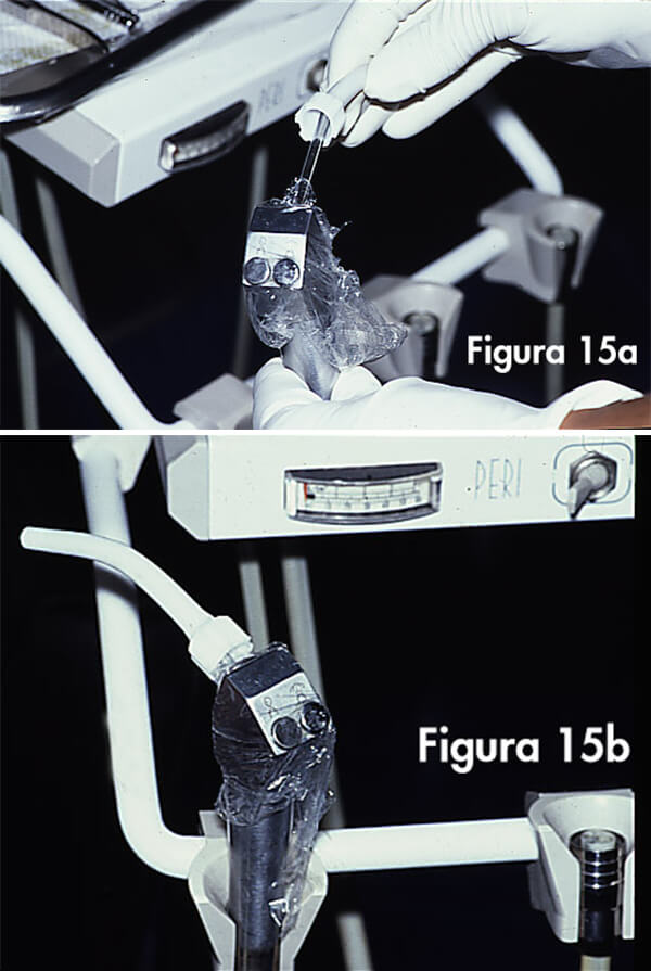 Fig. 15 La jeringa de agua y aire de la unidad debe ser protegida entre paciente y paciente. La manipulación de los instrumentos cortantes debe ser bien cuidadosa.(4,8,9)