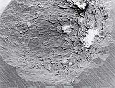 Fig. 6.- Cráter en esmalte y dentina, inducido por un Rayo Laser de Er:YAG (330 mJ, 5 pulsos). Note las paredes rugosas y un cráter en el fondo sin cambios termales. Imagen al microscopio electrónico de barrido X 80. (Tomado de Miserendino L., Pick R.)