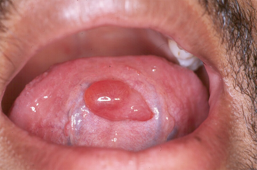 Foto Nº 1: Pre-operatorio
