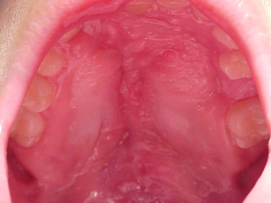 Foto 7