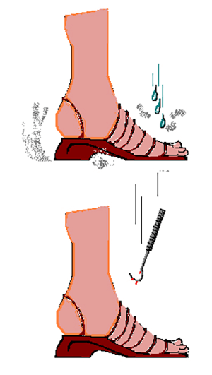 Figura Nº 3