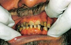 Fig. 1 Imagen clínica.