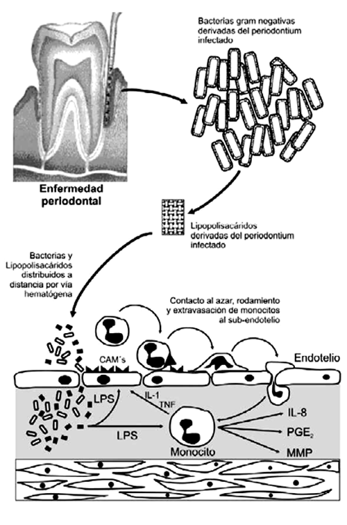 Figura 1.- Migración de los monocitos al sub-endotelio mediante el estímulo de los LPS bacterianos al promover la activación de las células endoteliales. Tomado de: ver referencia (68).