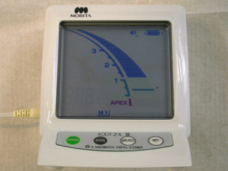 Fig. VIII: Localizador apical realizando la conductometría electrónica.