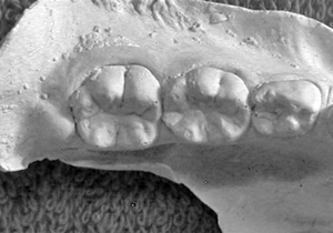 Figura 12. Protostílido segundo molar inferior temporal y primer molar inferior permanente expresión punto P o foramen secum (vista oclusal).