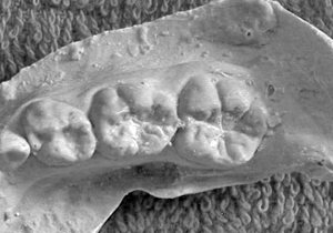 Figura 15. Segundo molar inferior temporal y primer molar inferior permanente: pliegue acodado; cúspide 6; cúspide 7; y protostílido (expresión cúspíde).