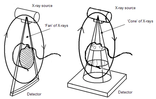 Fig.1 Ilustración del funcionamiento del sistema cone-beam