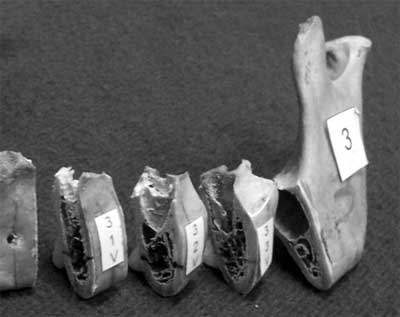 Figura 2 Mandíbula seccionada en cuatro sectores, segundo premolar (2PM), primer molar (1M), segundo molar (2M) y tercer molar (3M).