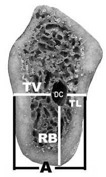 Figura 3 Esquema de las cinco medidas realizadas en los especímenes y las tomografías. Ancho del cuerpo mandibular en la zona del conducto dentario inferior (A), diámetro del conducto dentario inferior (DC), distancia del conducto dentario inferior hacia la tabla ósea vestibular (TV), lingual (TL) y basal (RB).