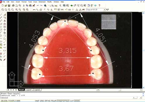 Cuadro 6 Medidas de los puntos demarcados por AutoCad 2000