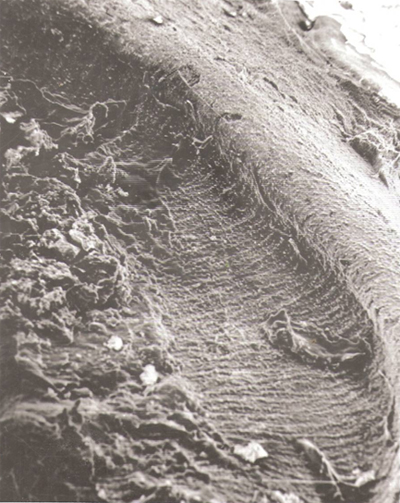 Fig. 1 En esta micrografía se puede observar zona del manto de la dentina con escasa cantidad de canalículos dentinarios. Barra: 50.