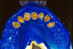 Figura 6: Impresión de transferencia