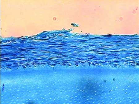 Figura 1 Grupo I - Suero fisiológico. Disposición paralela a la superficie radicular de las fibras del remaneciente del ligamento periodontal en toda la extensión de la raíz. Tricromio de Masson. Aumento original 400X.